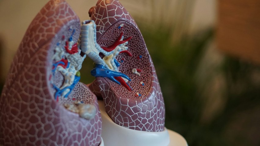 O câncer de pulmão, fortemente ligado ao tabagismo, evidencia a importância da tomografia precoce para aumentar as chances de cura